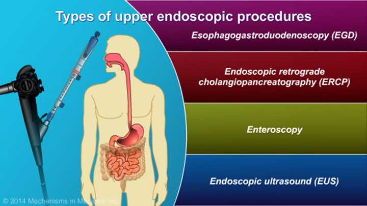 understanding-eus-fna