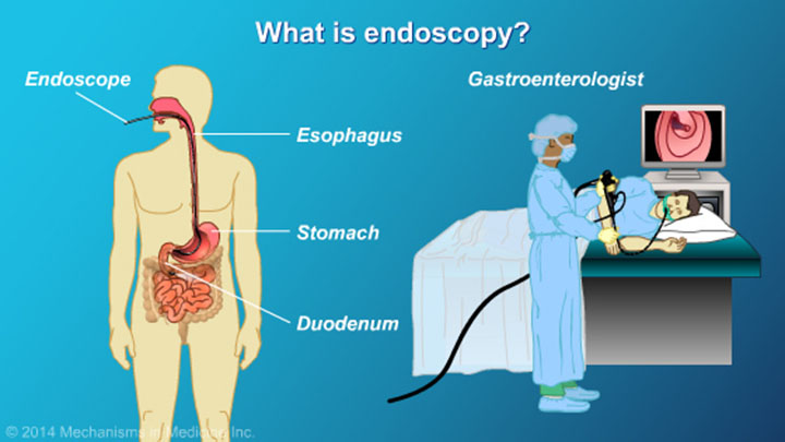 Understanding ERCP