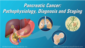 The Pathology Of A Newly Diagnosed Cancer