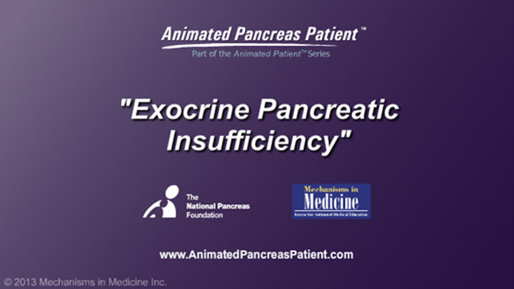 Slide Show Exocrine Pancreatic Insufficiency Epi