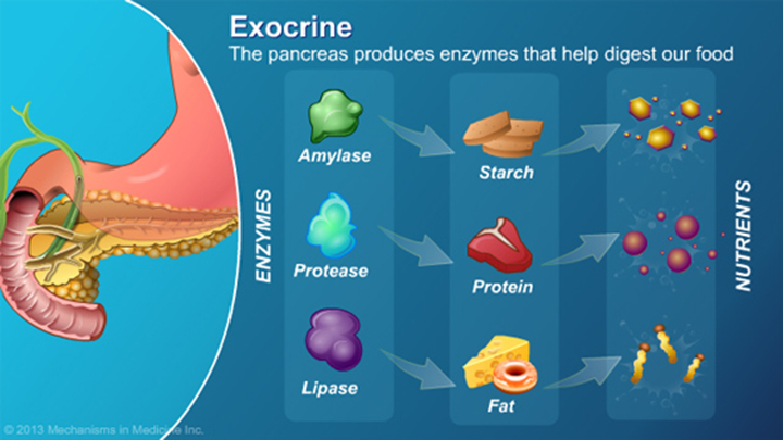 Exocrine Pancreatic Insufficiency (EPI)